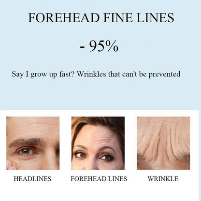 Beauty Forehead Line Removal Gel Patch Anti-wrinkle