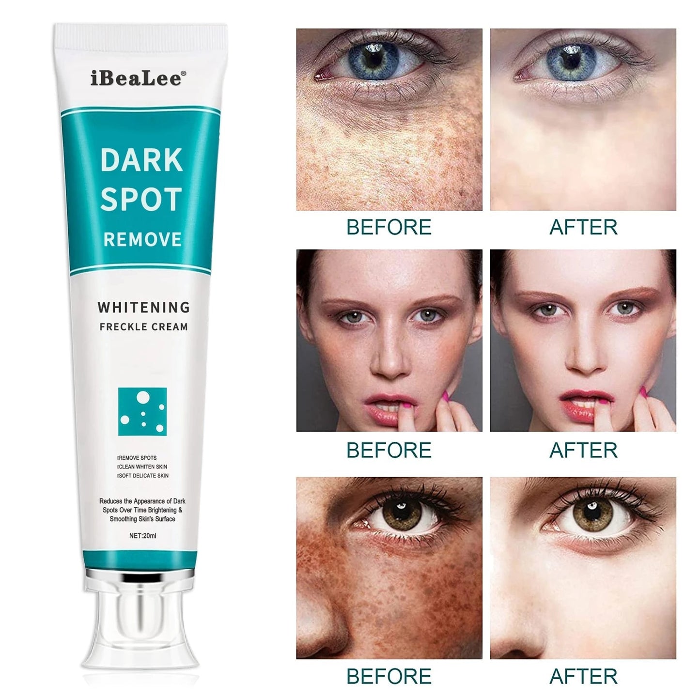 Beauty Whitening Freckle Cream Remove Melasma Cream