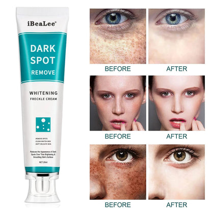 Beauty Whitening Freckle Cream Remove Melasma Cream