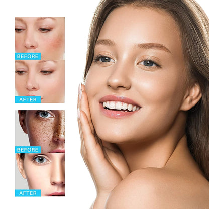 Beauty Whitening Freckle Cream Remove Melasma Cream