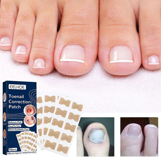 Nail Correction Stickers Ingrown Toenail Corrector Patches Health Product